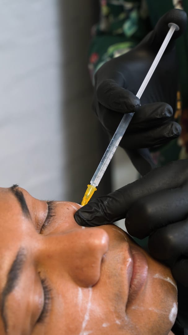 Dr Juan Bester performing precise under-eye injectable treatment demonstrating biostimulators vs dermal fillers at LightSculpt Green Point Cape Town