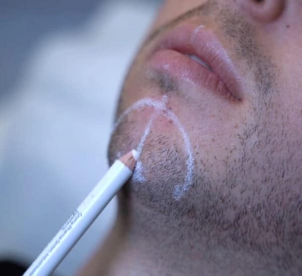 Men in aesthetics and subtle male aesthetic treatments at LightSculpt Green Point