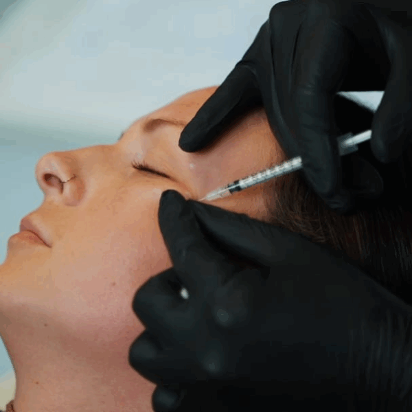 Patient receiving a personalised Botox treatment at LightSculpt in Cape Town.