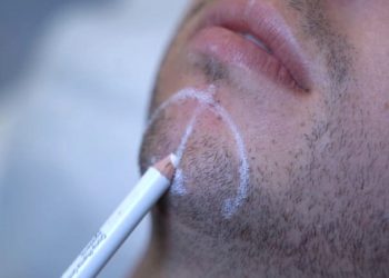 Men in aesthetics and subtle male aesthetic treatments at LightSculpt Green Point