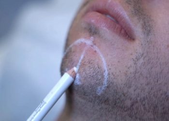 Men in aesthetics and subtle male aesthetic treatments at LightSculpt Green Point